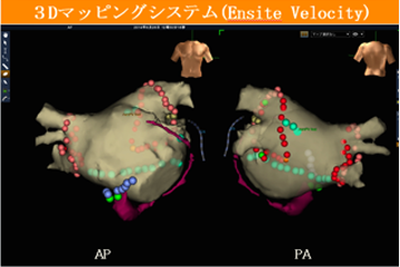 当院で使用できる3Dマッピングシステム2